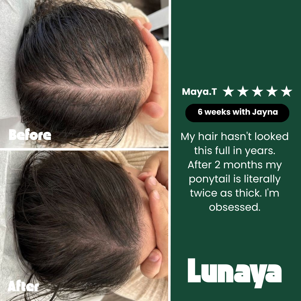 12-Plant Bar — Thicker, longer hair in just 8 weeks.