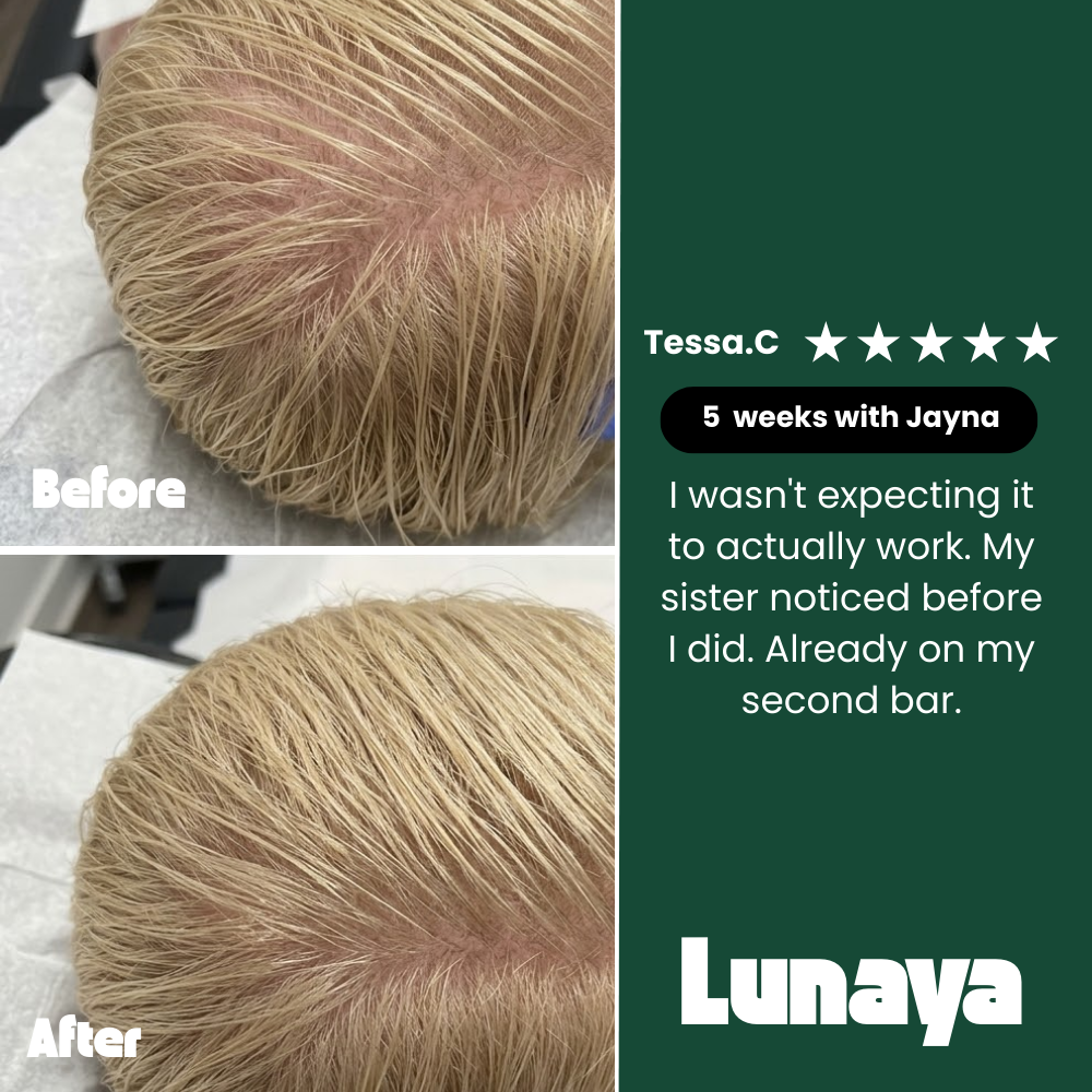 12-Plant Bar — Thicker, longer hair in just 8 weeks.